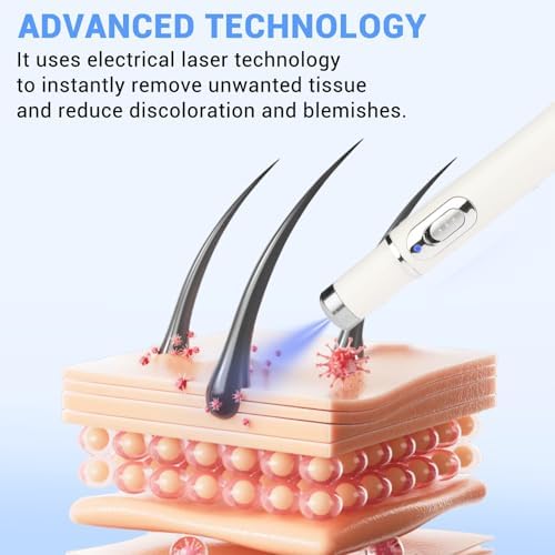 Maximum Strength WART Remover,Wart Removal Pen,Dark Spot Remover for Face and Body, Comfortable and Effevtive.