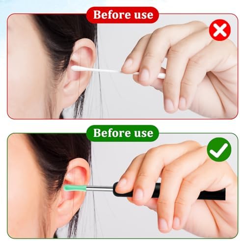 Ear Wax Removal Replacement Tips for Ear Camera 30Pcs Ear Spoon Tips for Wet/Dry Ear Ear Cleaner Tips Wax Cleaning Ear Spoons Tips Silicone Soft Cleaning Reuse Cap for Ear Wax Removal (Green)