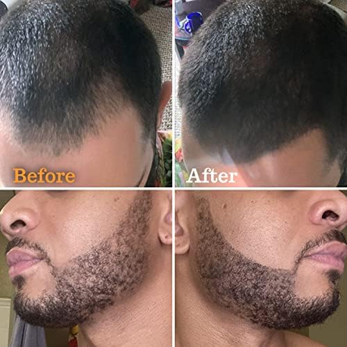 FOLLICLE BOOSTER Beard Pen Filler Styling Kit for Men - 3-in-1 Filling Set with 4-Tip Fork, Normal Pencil, and Brush - Waterproof, Sweatproof & All-Day Hold - Deep Dark Brown