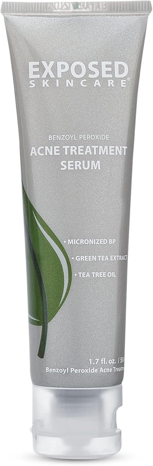 Exposed Skin Care Acne Treatment Serum Step 3 â Quickly Reduces Pimple Size and Redness - 12 Hour Spot Treatment - 3.5% Benzoyl Peroxide, Natural Green Tea & Tea Tree Oil