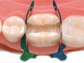 Clinic pack of 100 (same size)