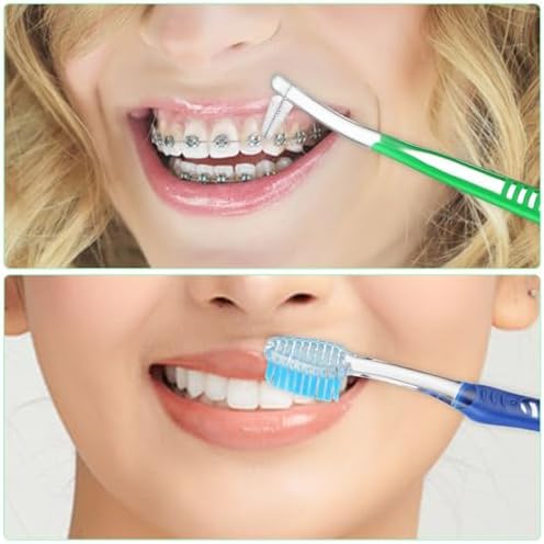 Tyqour 4 Pack Orthodontic Toothbrush for Braces Brushes for Teeth with Interproximal Head Double Ended Soft Bristles for Ortho Brace Teeth Cleaning