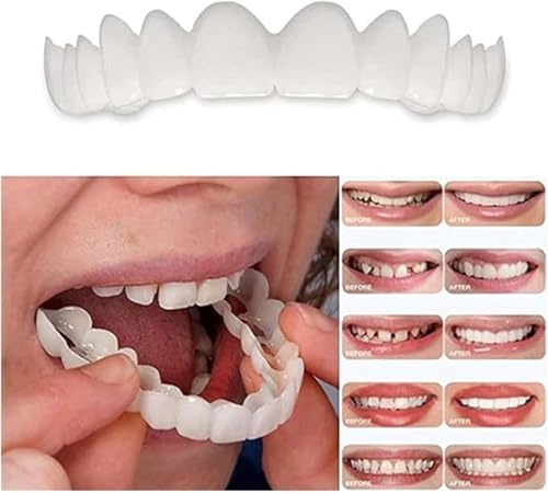 2 Pairs Adjustable Smile Veneers, Natural-Looking Comfort for Men and Women (Natural White1)