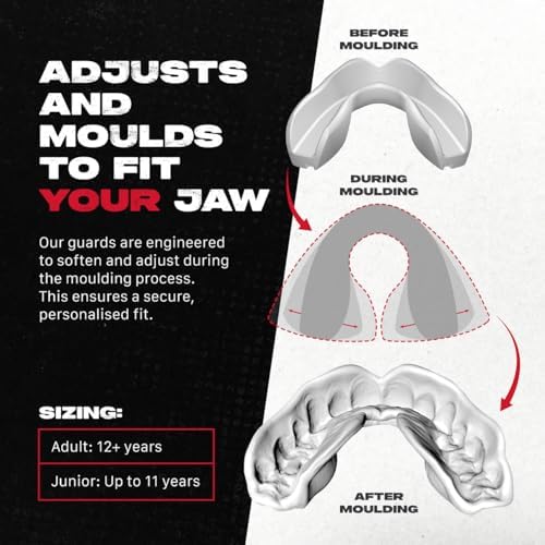 SAFEJAWZ Mouth Guard, Slim Fit Mouthguard for Adults & Youth with Case, Easy Fit Remoldable Mouthpiece for Football, Boxing, Lacrosse, MMA, Basketball & All Contact Sports