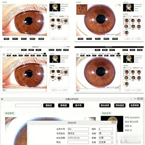 Iridology Camera Analyzer, 5.0 Mp USB Iriscope Iris Analyzer Iridology Camera, Eye Iridology Camera, HD 30x Iris Lens and Driver-Free Analysis Software