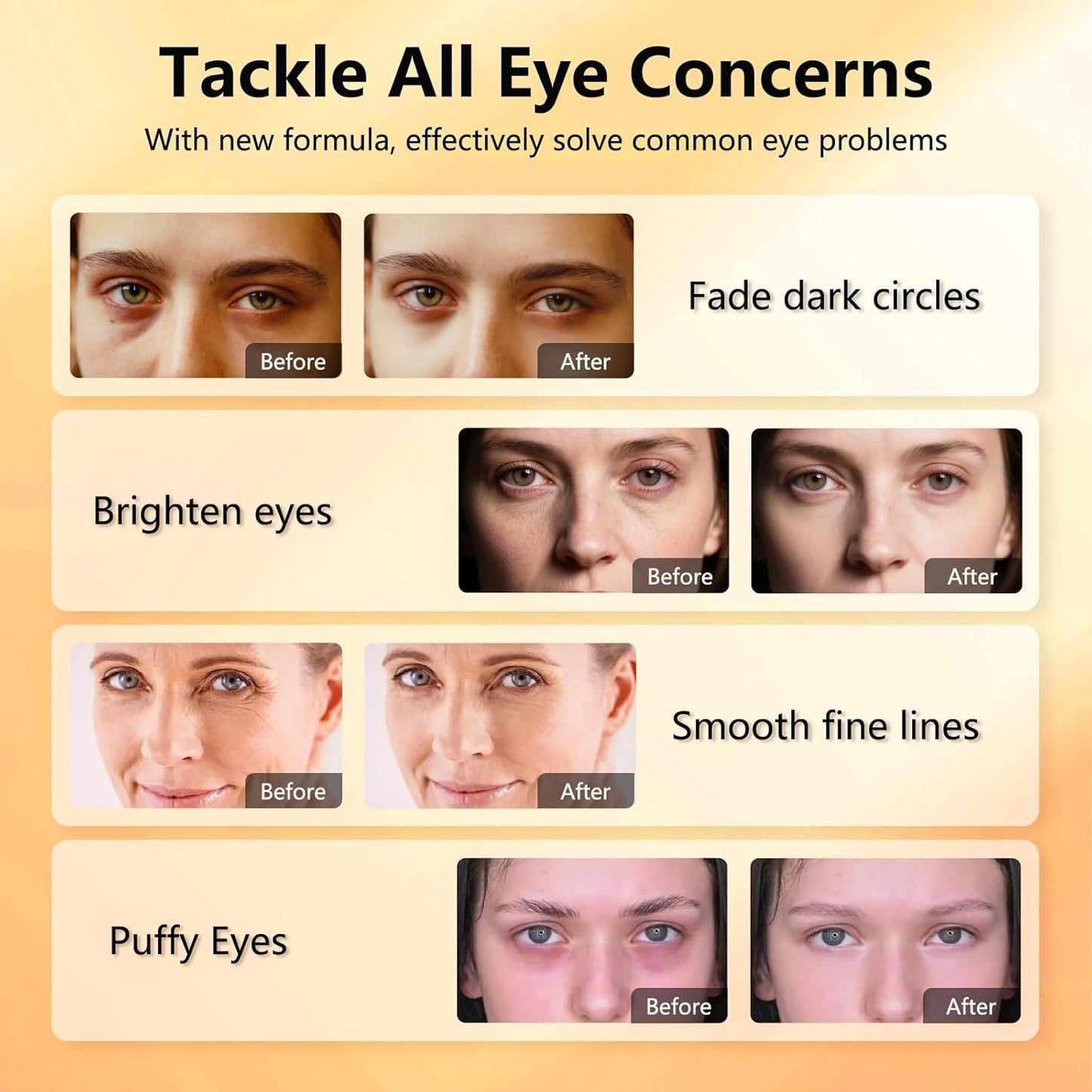 Under Eye Patches with Vitamin C & Caffeine 30 Pairs for Dark Circles, Fine Lines and Puffiness, with Niacinamide Hydra-Gel Collagen, Skin Care for Men & Women