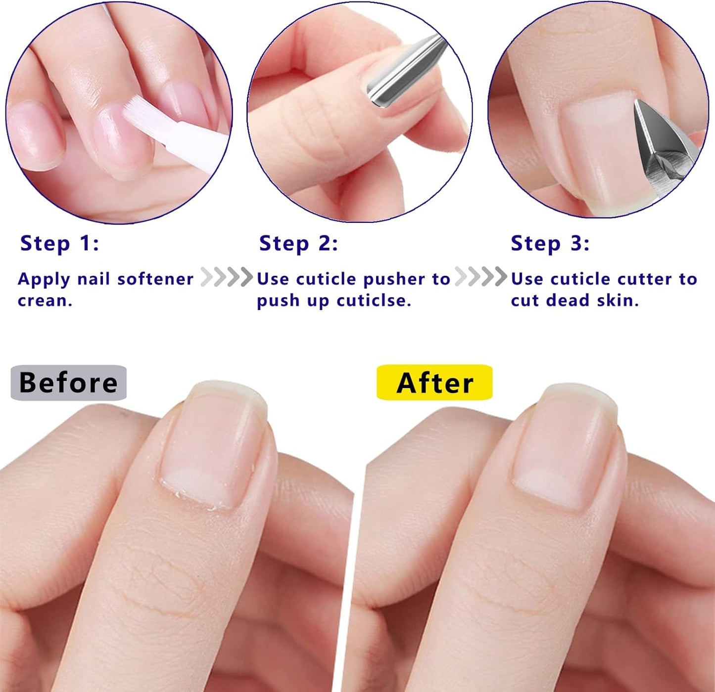Cuticle Trimmer Cuticle Remover with Cuticle Pusher, XUNXMAS Professional Stainless Steel Durable Pedicure Manicure Tools Cutter Nipper Scissor Clipper for Fingernails and Toenails Dead Skin Blue
